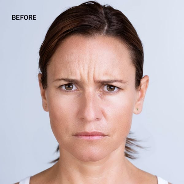 a woman scowling with deep wrinkles on her forehead