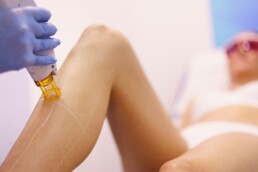 a woman receiving laser hair removal treatment on her legs