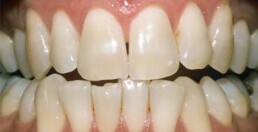 A close up of a person's teeth, highlighting their perfect dental health.