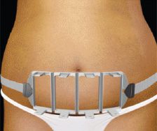 A woman in a bikini with a metal belt on her stomach enjoying wellness services at Limelight Medical Spa in Cincinnati.