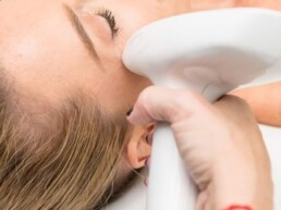 A woman getting a hair removal treatment at Limelight Medical Spa in Cincinnati.