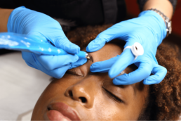 A woman receiving eyebrow tattooing at Limelight Medical Spa in Cincinnati.