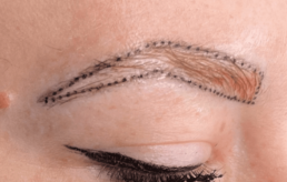 An image of a woman's eyebrows at Limelight Medical Spa in Cincinnati.