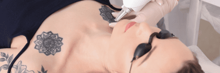 A woman is getting a tattoo on her chest at a Laser Center.