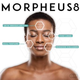 Advertisement for morpheus8 treatment highlighting its benefits for skin irregularities, fine lines, and dull texture through advanced micro-needling technology.